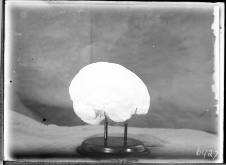 Australian Institute of Anatomy, cast of a skull.