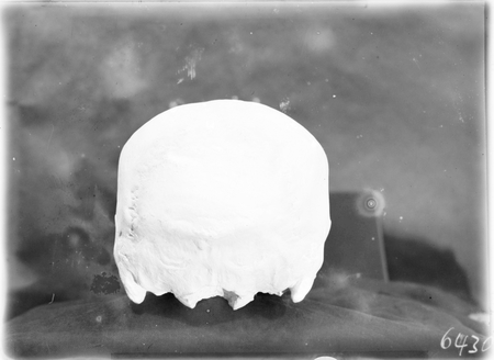 Australian Institute of Anatomy, cast of a skull.