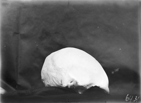 Australian Institute of Anatomy, cast of a skull.